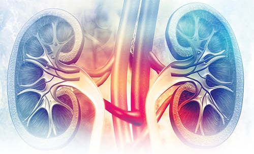 ckd-600x367-hero-with-fade